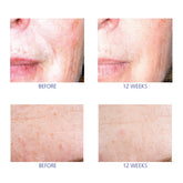iS Clinical Active Serum