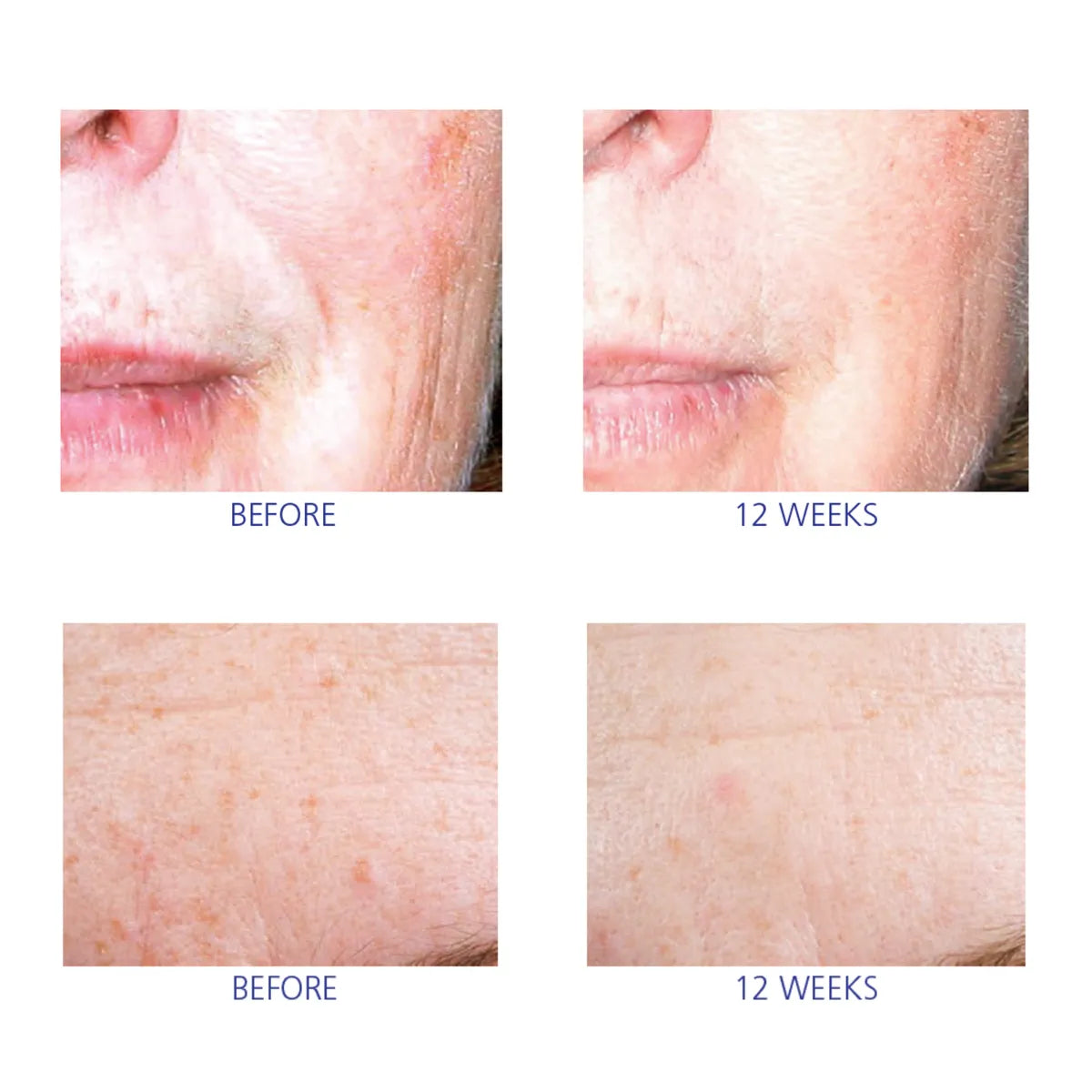iS Clinical Active Serum