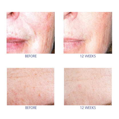 iS Clinical Active Serum
