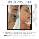 iS Clinical Active Serum